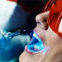 профессиональная чистка зубов