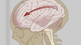 сотрясение мозга симптомы