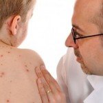 корь симптомы у детей