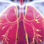 пневмония симптомы у взрослых